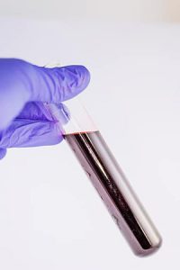 اختبار-الحمل-تحليل-الدم