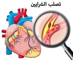 ضربات الشرايين الناتجة عن انقباضات القلب