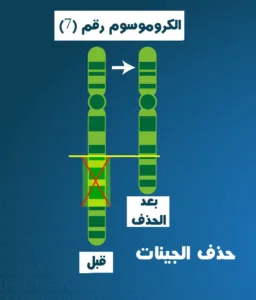 حذف-الجينات-كروموسوم7